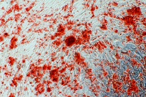 骨芽細胞Alizarin Red S染色