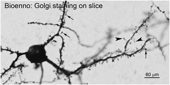 浮遊切片にゴルジ染色を行うキット sliceGolgi Kit　神経細胞の染色