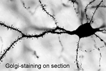 浮遊切片にゴルジ染色を行うキット sliceGolgi Kit　神経細胞染色例