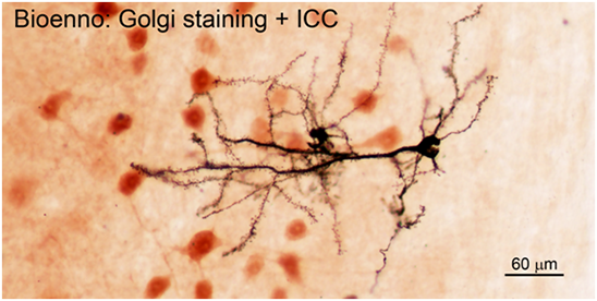浮遊切片にゴルジ染色を行うキット sliceGolgi Kit　神経細胞の染色