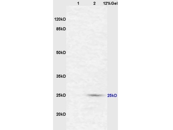 CD161ｃ/NK1.1 Polyclonal Antibody