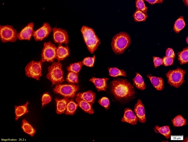 Anti-VEGF Polyclonal Antibodyを用いた染色画像