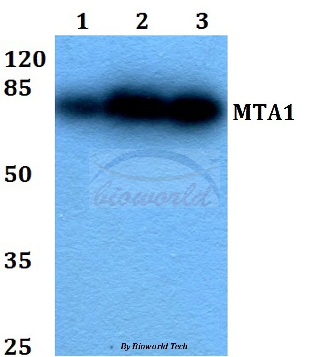 抗MTA1（K182）抗体