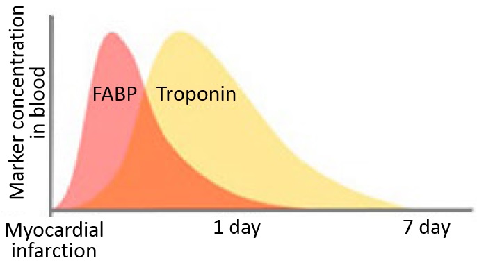 トロポニンとH-FABPの組み合わせ