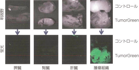 腫瘍部位を特異的に検出できる蛍光イメージングナノ粒子 Tumorgreen Tumorred フナコシ