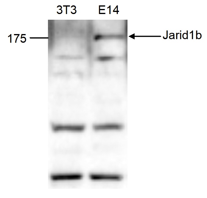 抗JARID抗体使用例2