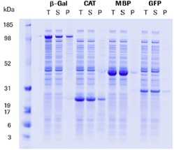 RTS 500 ProteoMaster E. coli HY Kitの各種タンパク質のクマシー染色ゲル分析