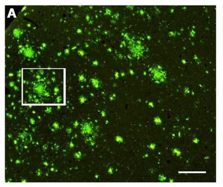 HO-Qによる大脳皮質内のアミロイド斑蛍光染色像A