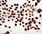パラフィン包理 HeLa 細胞切片を抗 PCNA 抗体（#M-990-100）を用いて免疫染色した。