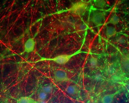 ラット中枢神経系の混合培養細胞を抗α Internexin抗体(#M-1378-250, 赤)および抗MAP2抗体(#C-1382-50,緑)で蛍光免疫染色した。