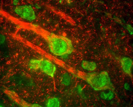 ラット大脳皮質を抗Neurofilament Medium 抗体(#R-1395-50, 赤)で蛍光免疫染色した。