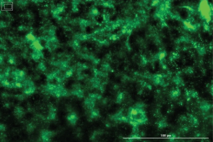 LNP-0315で肝細胞株に導入（緑色）