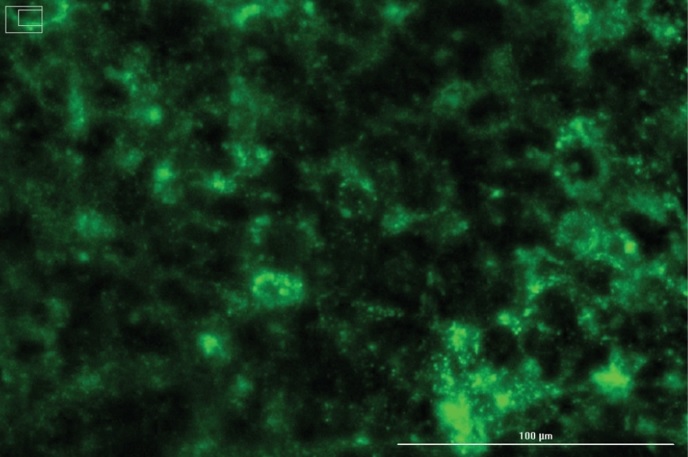 LNP-102で肝細胞株に導入（緑色）