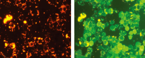 RAW264.7細胞の食作用の蛍光顕微鏡による観察