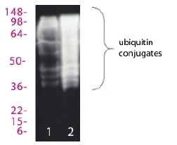 ユビキチン化タンパク質抽出キットの使用例