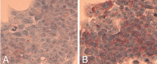 HepG2細胞における脂肪滴蓄積に及ぼすクロロキン（Chloroquine）の影響