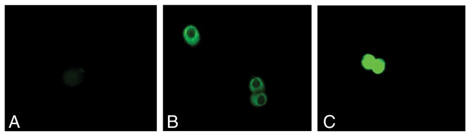 S-グルタチオニル化タンパク質の免疫蛍光染色像