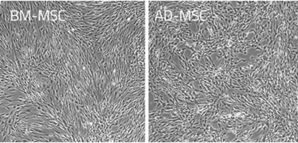 CnT-Prime MSC Medium Xeno-Freeを用いて培養した各種ヒト間葉系幹細胞の顕微鏡像