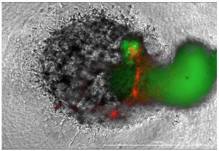 活性化T細胞およびび間葉系幹細胞（MSC）との共培養における膵臓がんモデル（2時間後）