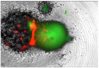活性化T細胞およびび間葉系幹細胞（MSC）との共培養における膵臓がんモデル（19時間後）
