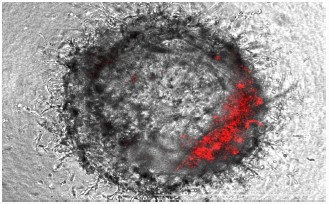 活性化T細胞との共培養における膵臓がんモデル（21時間後）