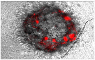 活性化T細胞との共培養における膵臓がんモデル（44時間後）