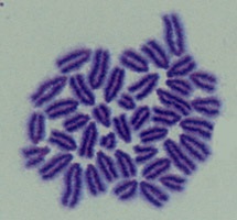 正常マウス細胞の染色体