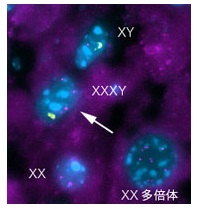 オスマウス細胞を移植した雌マウス肝臓でXY FISHにより検出された融合細胞