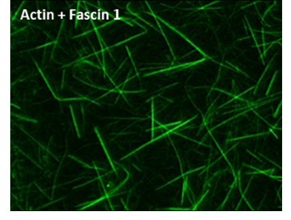 アクチンとFascin-1の蛍光顕微鏡像