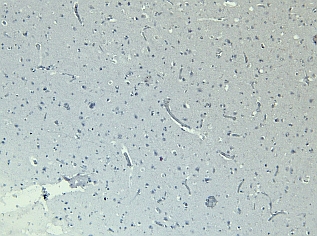 抗ChT(SLC5A7)抗体を用いたWB像