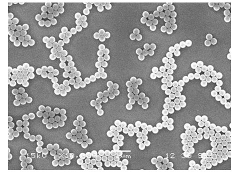 化学結合用ラテックス粒子の電子顕微鏡写真