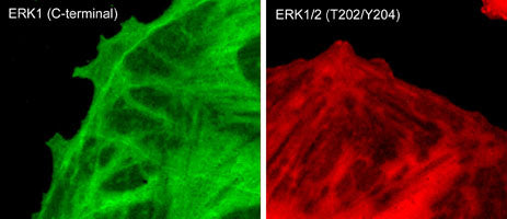 ERK1/2 Phospho-Regulation Antibody Kitを用いた免疫細胞染色像