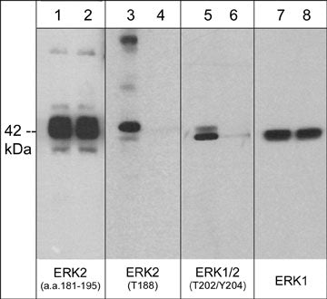 ERK1/2 Phospho-Regulation Antibody Kitを用いたウエスタンブロッティング像
