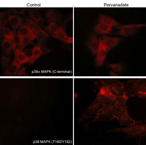 p38 MAPK Phospho-Regulation Antibody Kitを用いた2C12細胞の細胞染色像