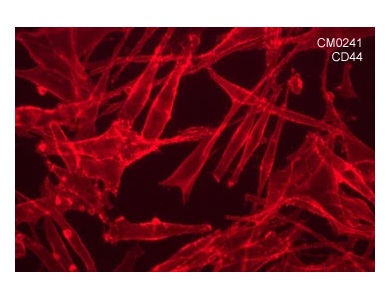 抗CD44抗体（#CM0241）の免疫細胞染色