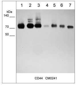抗CD44抗体（#CM0241）のWestern blot