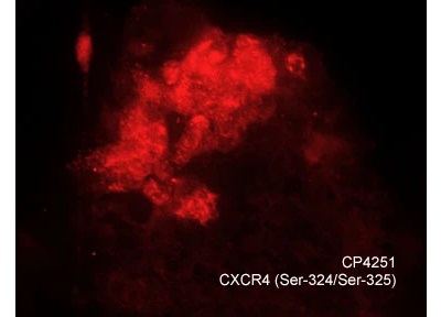 CXCR4 Antibody Sampler Kitの細胞染色像