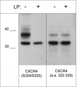 CXCR4 Antibody Sampler KitのWB像