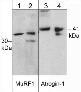 抗MuRF1抗体（左）および抗Atrogin 1抗体（右）を用いたウェスタンブロッティング像