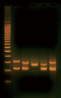 PCR-based VNTR Human DNA Typing Kitの使用例