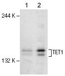 抗TET1抗体(#A-1020)の使用例