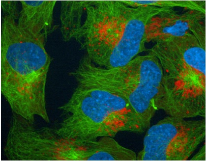 蛍光タンパク質ノックイン安定発現株細胞