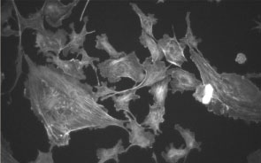 内皮細胞の重合型アクチン（F-actin）のAlexa Fluor（R） 488標識ファロイジンによる蛍光染色像