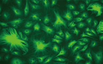 BPAE細胞のAlexa Fluor（R） 488標識ファロイジンによる蛍光染色像