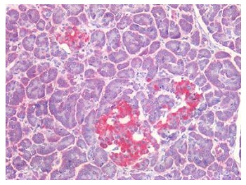 Recombinant Mouse Anti-Human CD56 Antibody（#0566P）を用いた免疫染色像