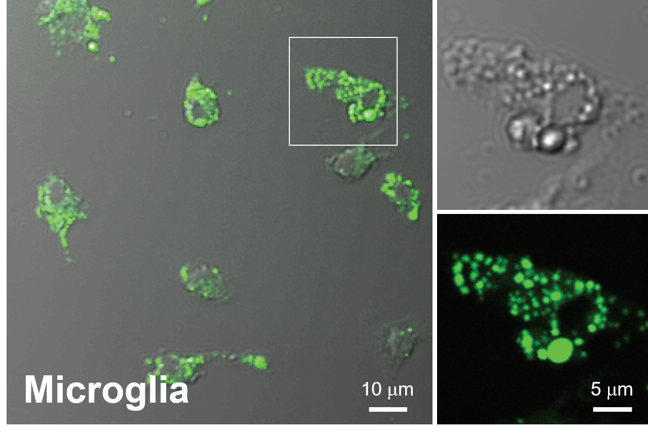 二光子顕微鏡によるミクログリアの観察