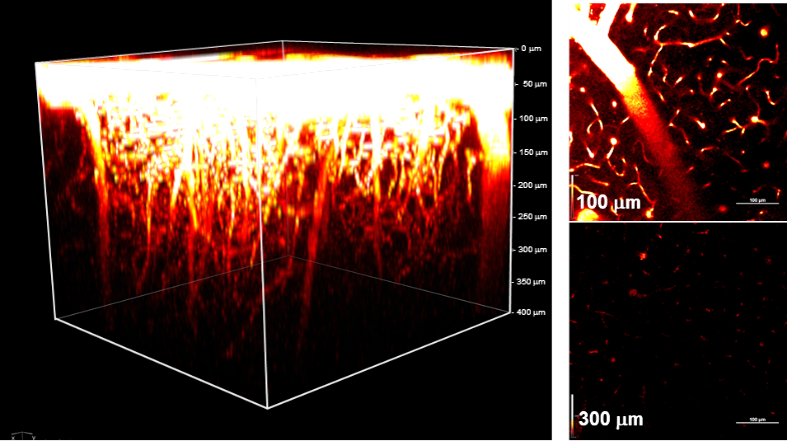 in-vivo-deep imaging of blood vessels in live mouse brain
