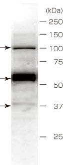 Fig.3 Western Blotting data of A549 cell lysate. Core protein (~37 kDa) and other bands can be detected by difference of glycosylation.