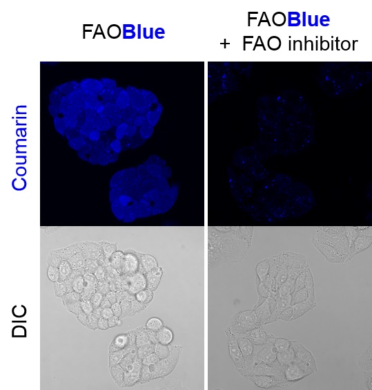 生細胞の脂肪酸β酸化（FAO）活性を蛍光定量できる試薬