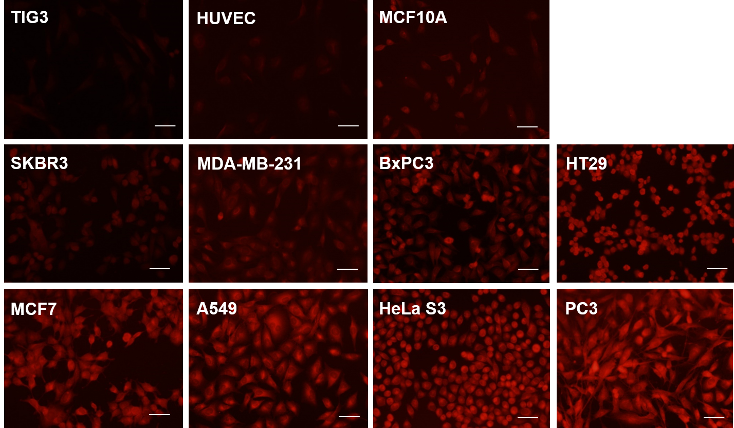 細胞種ごとのアクロレイン産生量の比較写真